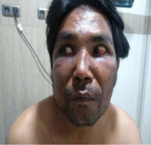 Ketua Dan Sekjen DPP SPRI Pusat Meminta Polda Sumut Untuk Mengusut Tuntas Kekerasan Terhadap Wartawan Media Online Post Medan Oleh Oknum Polisi