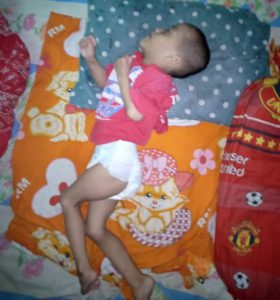 Butuh Perhatian Bupati Tangerang, Rijal Bocah 7 Tahun  Penderita Gizi Buruk Mengalami Lumpuh Total